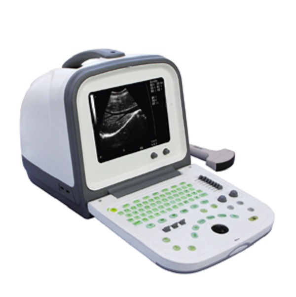 CE/ISO Approved Portable Ultrasonic Ultrasound Scanner for Vet (MT01006122)