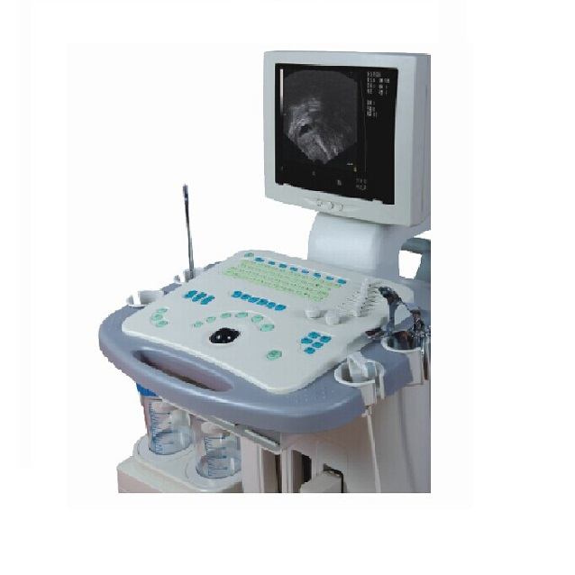 CE/ISO Approved Gyn Visible Ultrasonic Diagnostic System Machine (MT01006081)